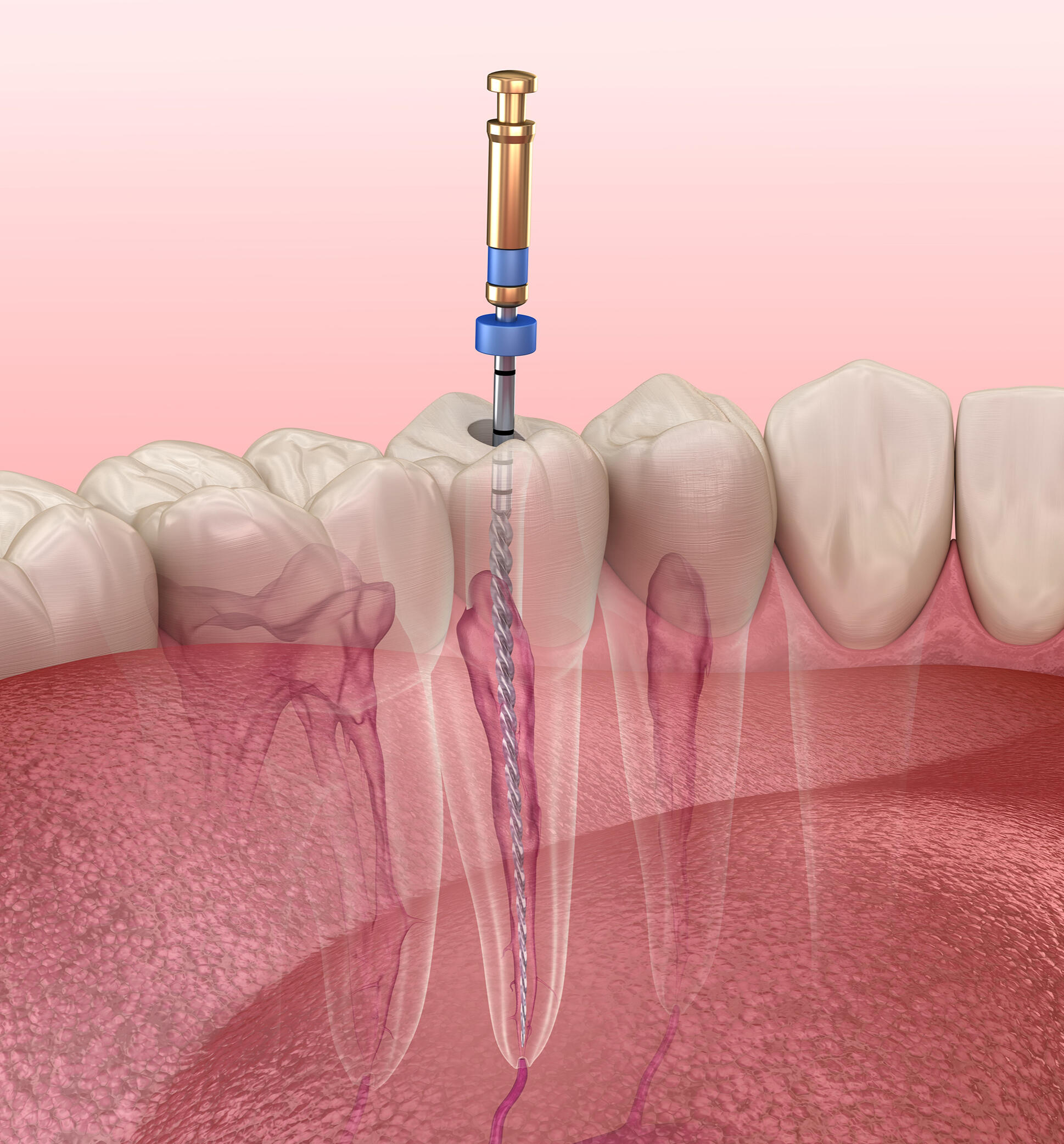 Endodoncia